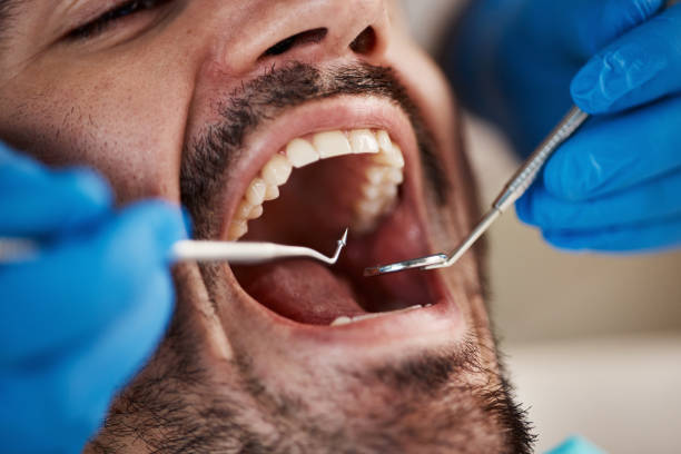 Best Broken or Cracked Tooth Emergency Dentist in Sa Loma, CA